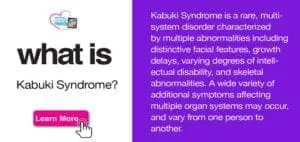 What is Kabuki Syndrome