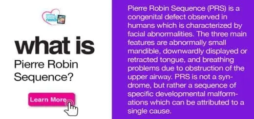 What is Pierre Robin Sequence