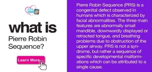 What is Pierre Robin Sequence