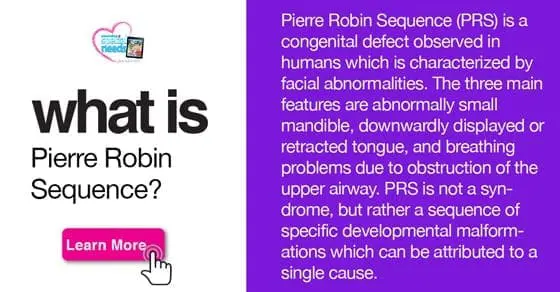 What is Pierre Robin Sequence