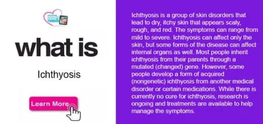 What is Ichthyosis