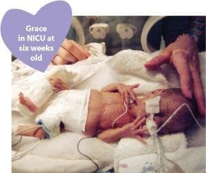 Grace is six weeks old at Saint Mary’s NICU Hospital in Rochester, MN.